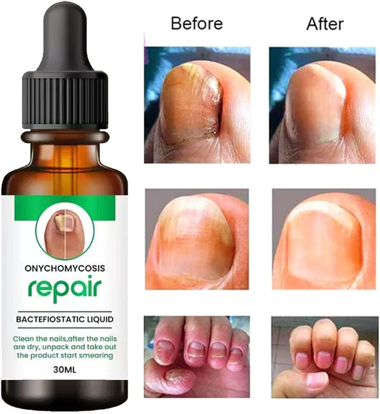 Nail Growth Repair Serum - Buy1 & Get1 Free