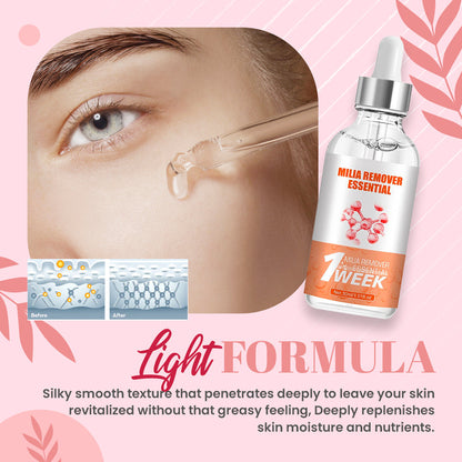 DermaPRO Speedy Milia Remover