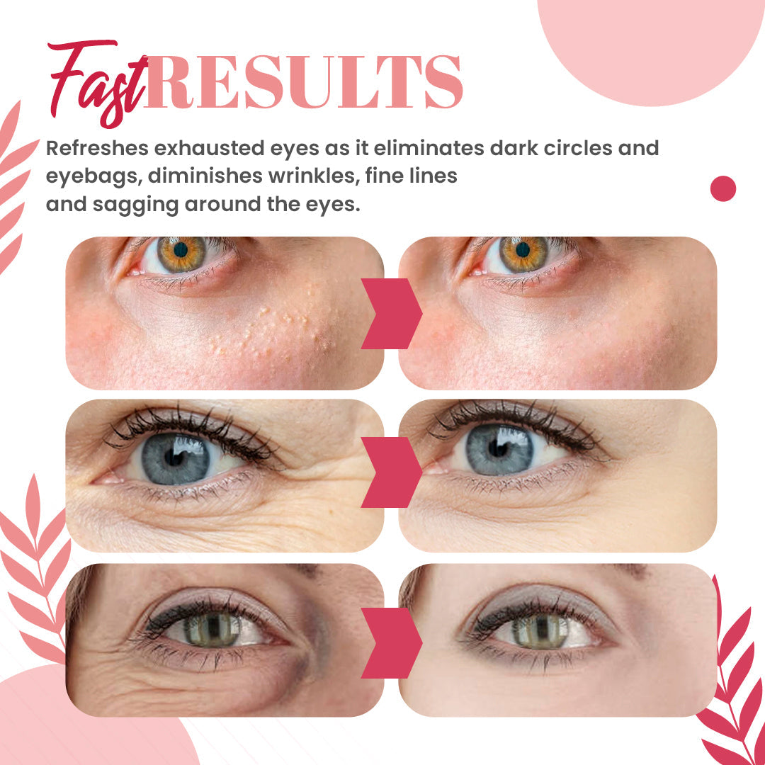 DermaPRO Speedy Milia Remover